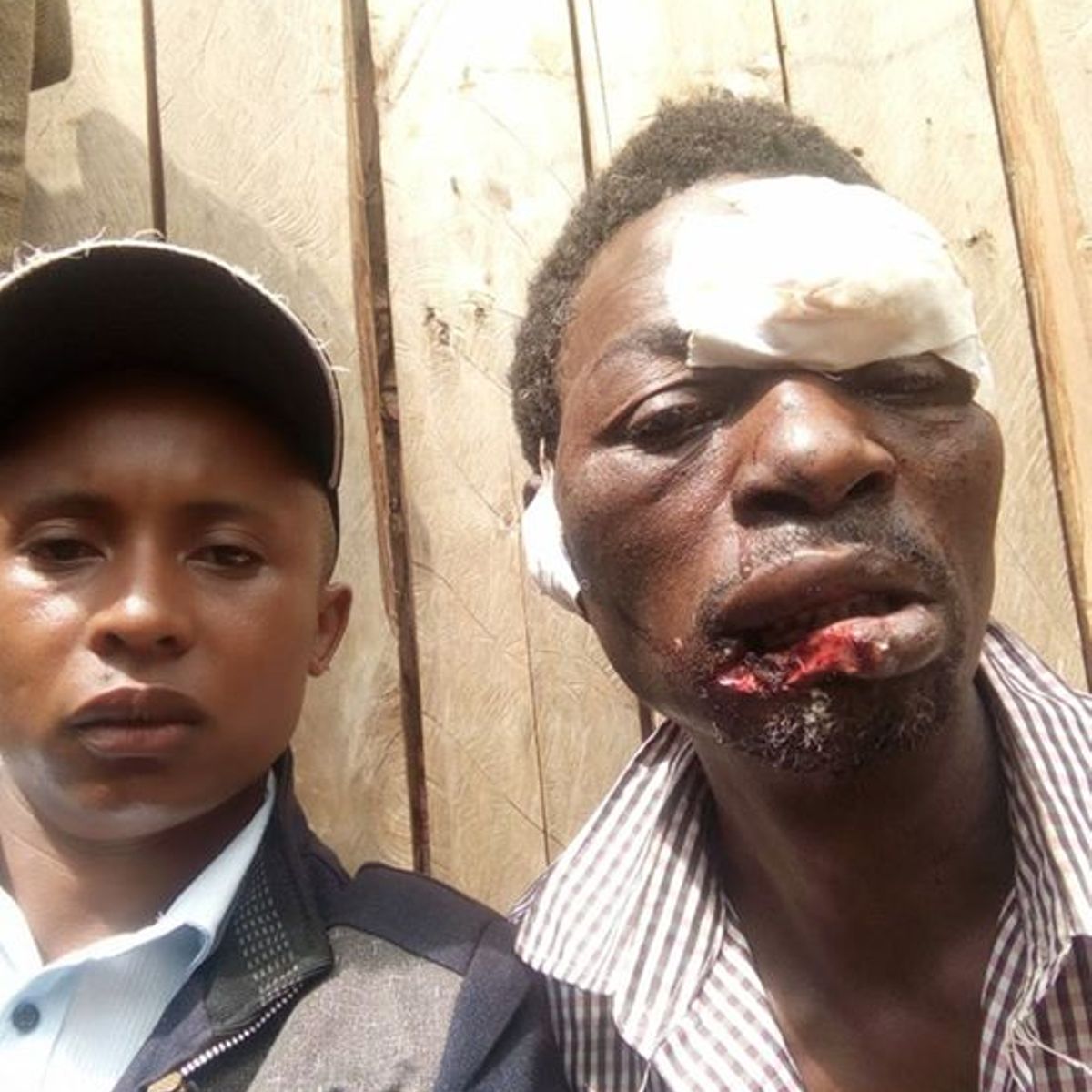 Shock As Thugs Bite Mans Lips In A Night Attack