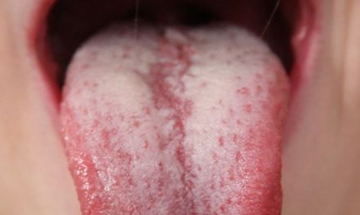 Why your baby could be having oral cancer