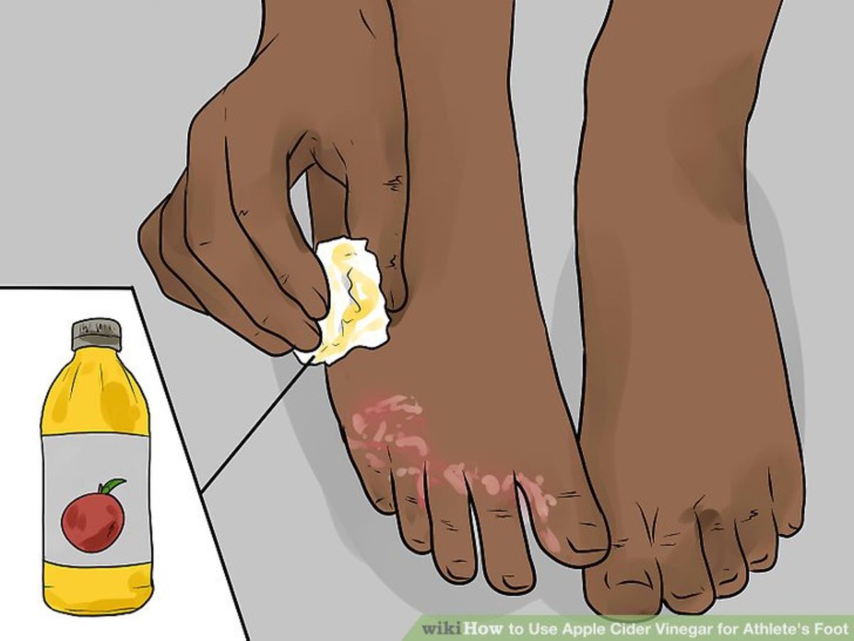 The only proven way to remove odor from sandals right now
