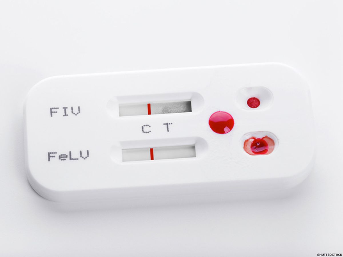 Reasons behind false positive results on HIV tests