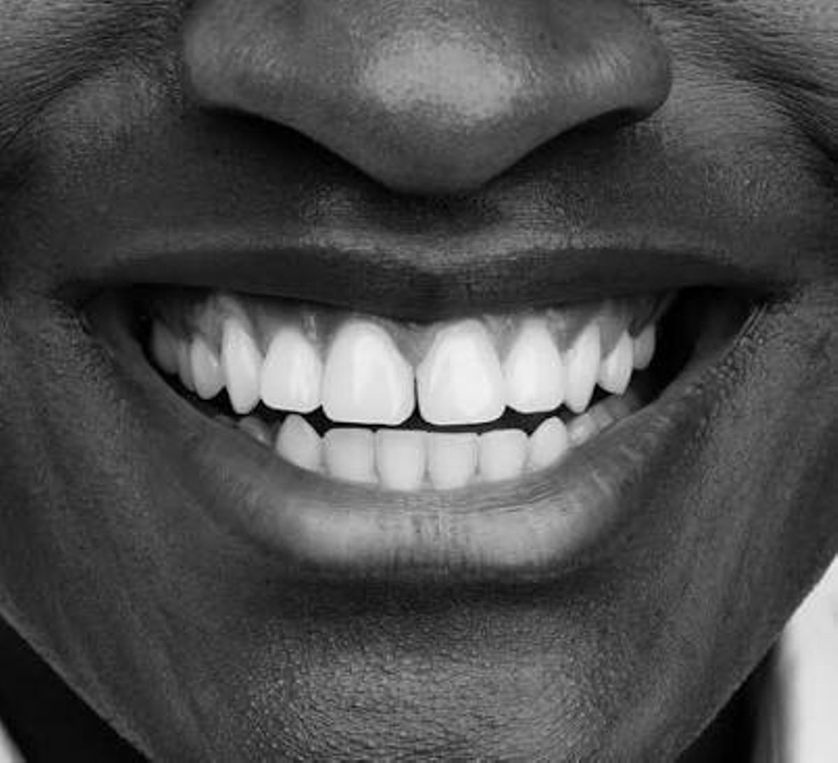 How to whiten stained teeth at home